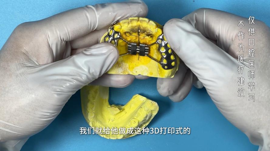 正畸手术是什么