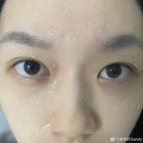 skii洗面奶蜇眼睛