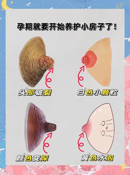 正常乳头什么样子