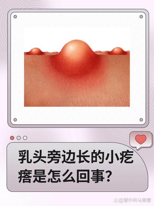 正常乳头什么样子