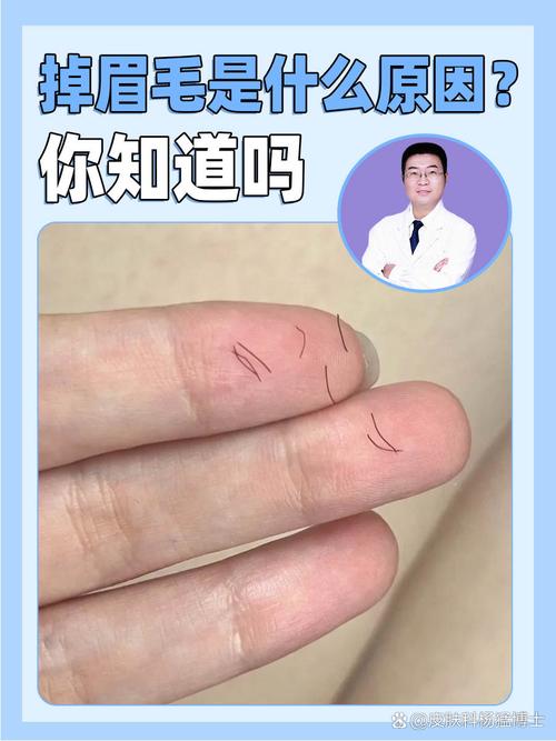 为什么老是掉睫毛