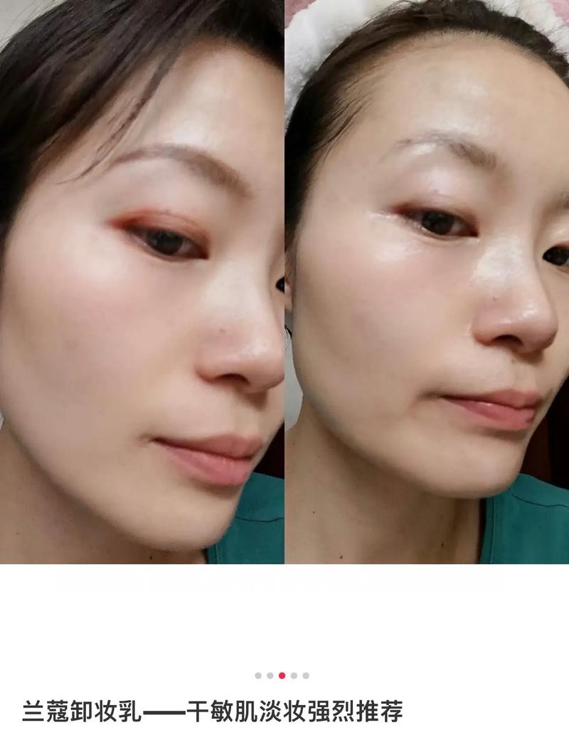 卸妆乳还需要洗面奶吗