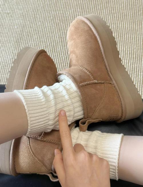 白色ugg怎么搭配