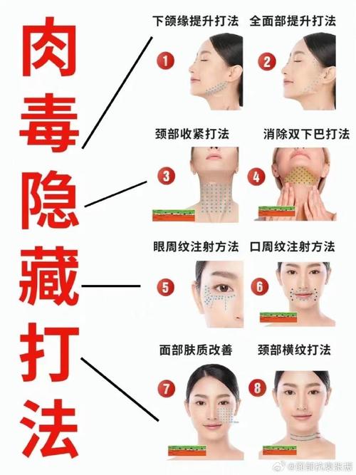 打什么针可以瘦脸