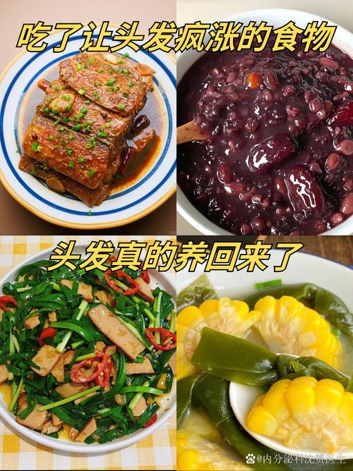 掉发应该吃什么