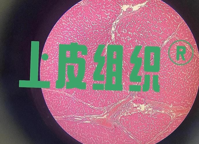 橘皮组织是什么