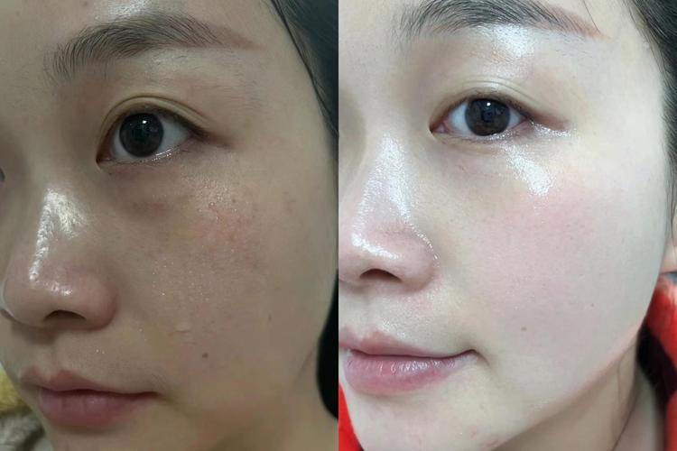 护肤品适合20岁使用的