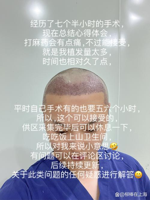 什么是头发种植