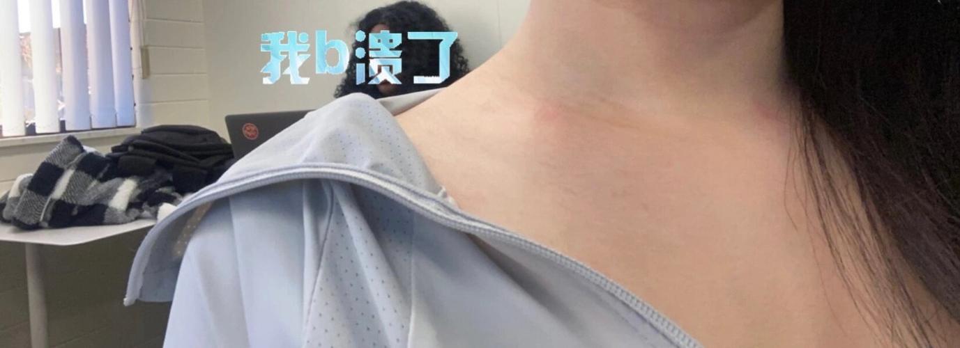 锁骨为什么不明显