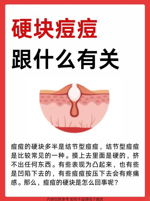 红肿痘痘是什么原因