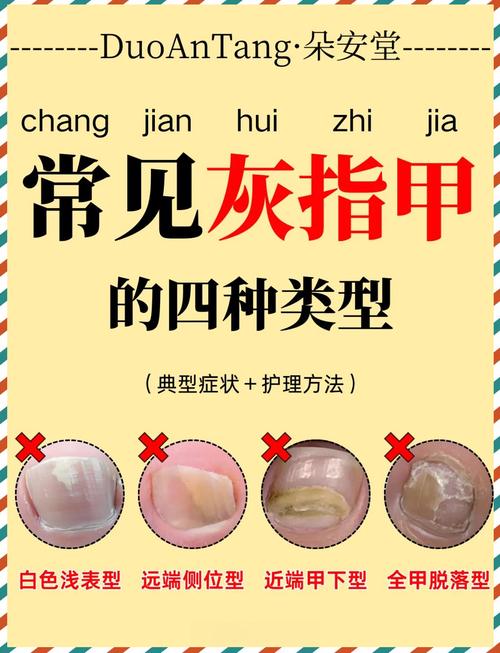 指甲痛看什么科