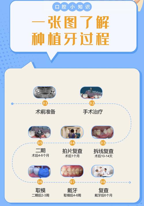 植牙是什么意思