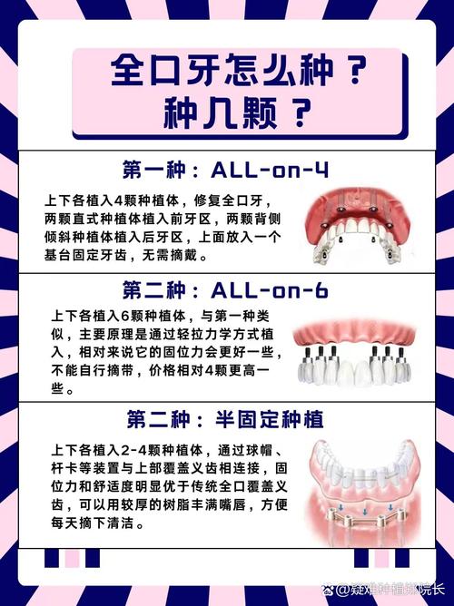 植牙是什么意思