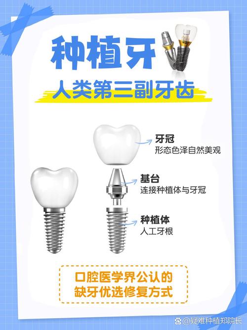 植牙是什么意思