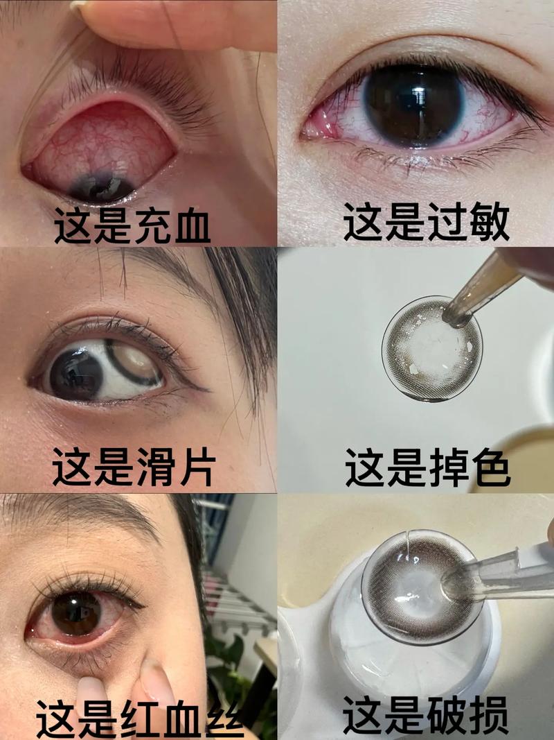 美瞳有什么坏处