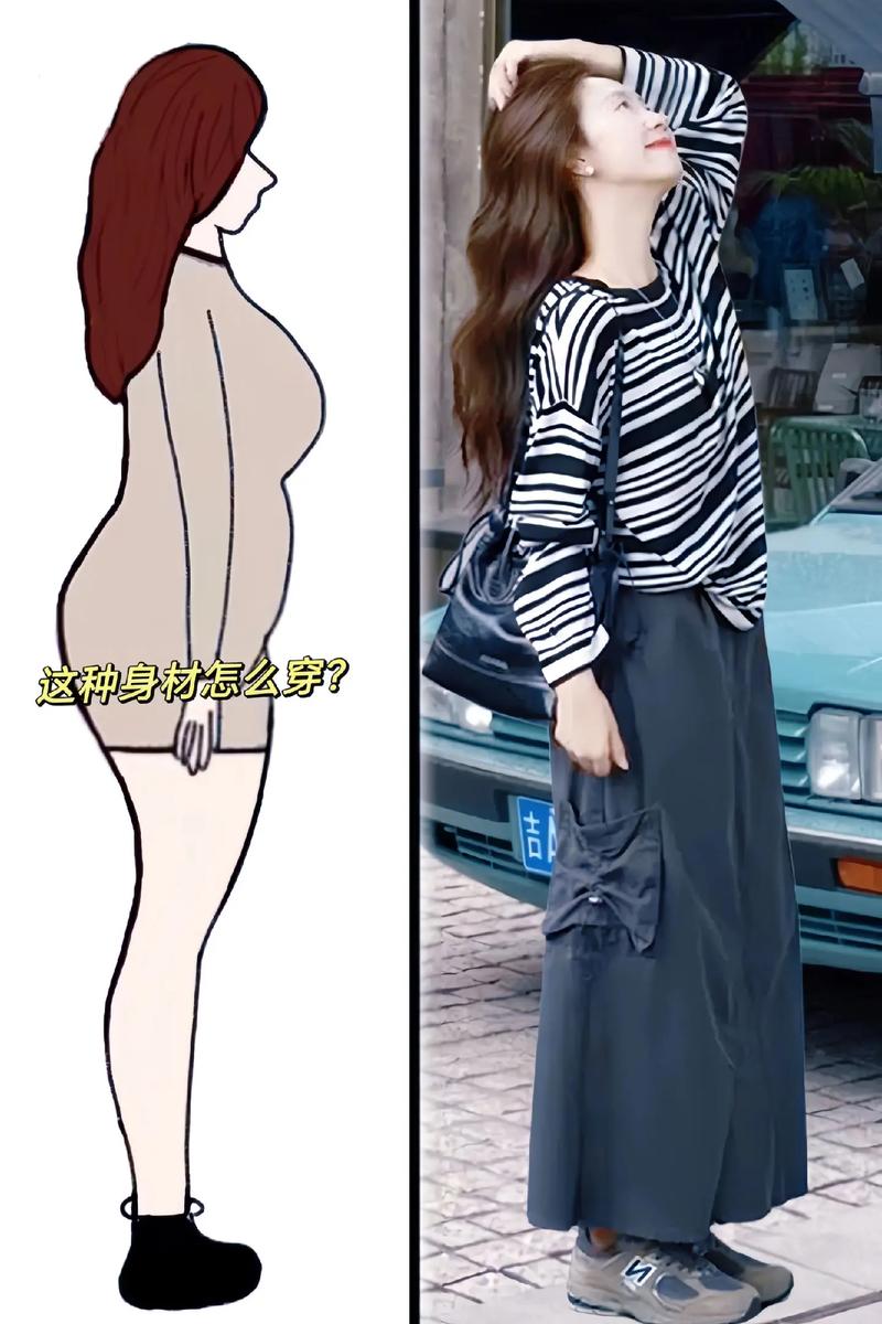 条纹中长款怎么搭配图片