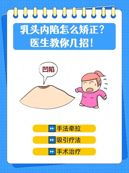 什么是乳头内陷