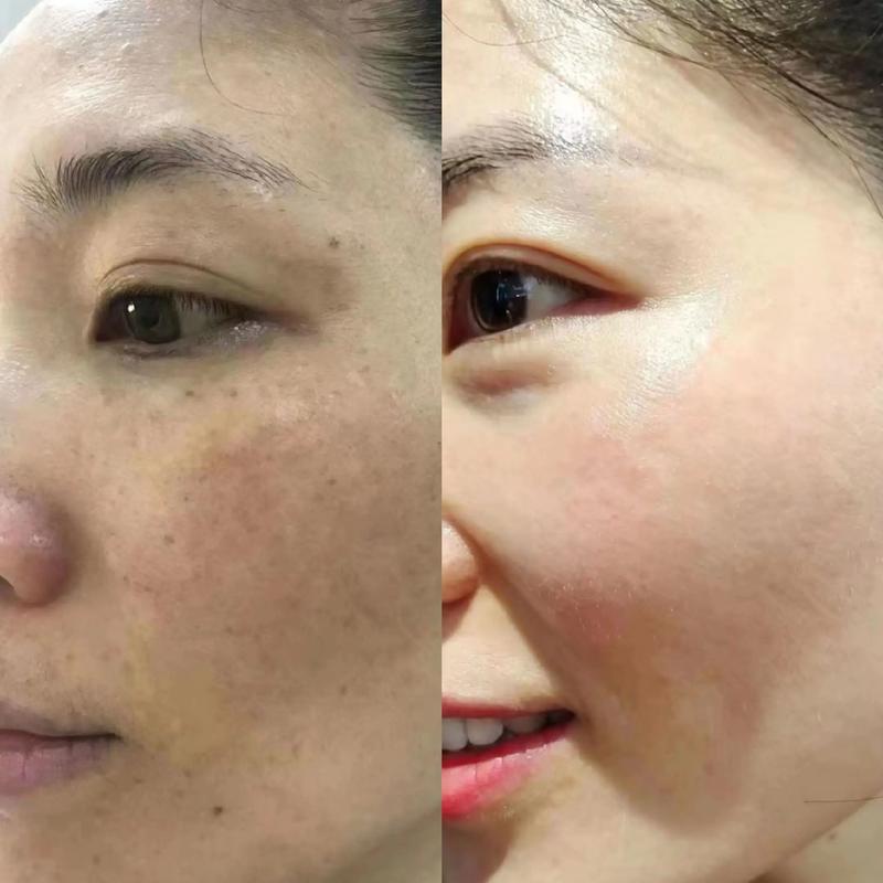 为什么皮肤暗黄暗黄的