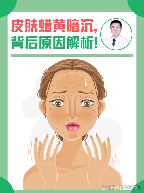 为什么皮肤暗黄暗黄的