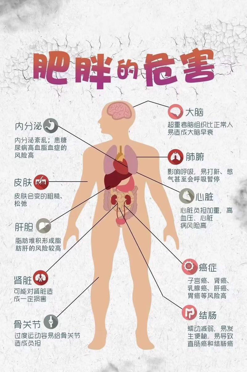 肥胖容易得什么病