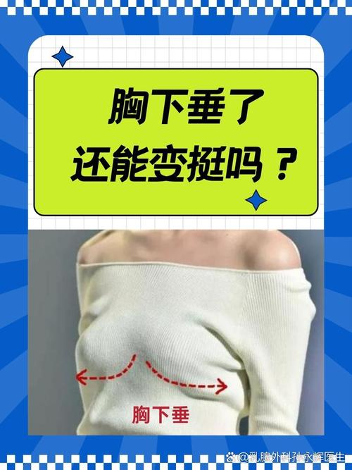 乳房下垂为什么