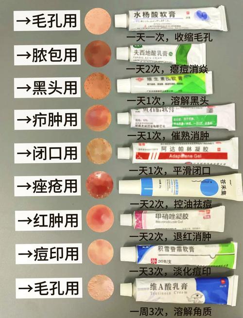 有能祛痘坑的护肤品吗