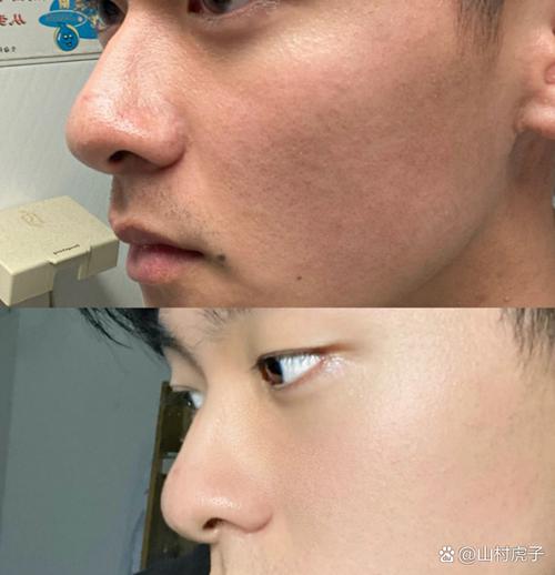 男生用不用洗面奶洗脸