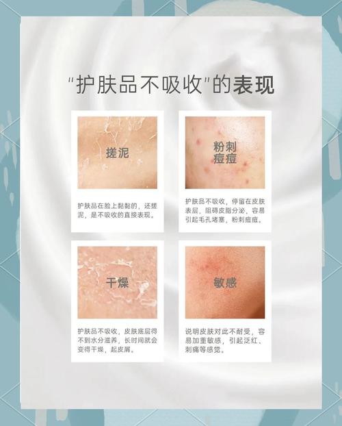 护肤品不合适会怎么样