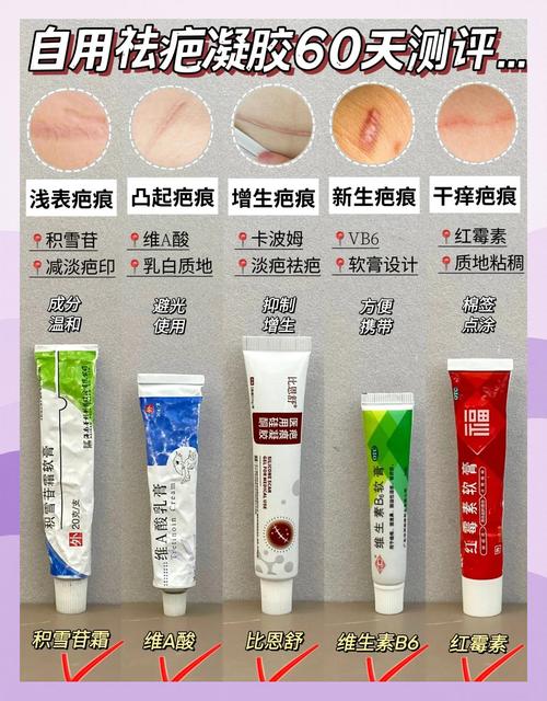 什么祛疤最好