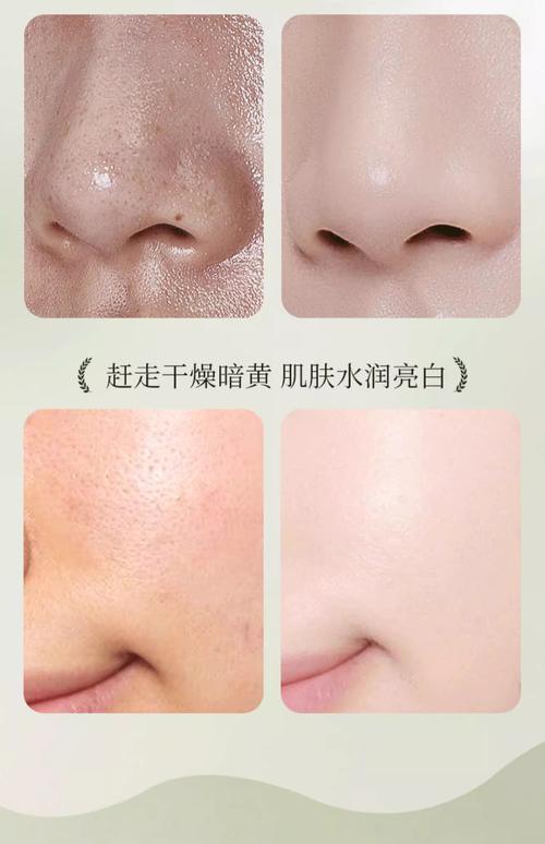 干性洗面奶和油性皮肤