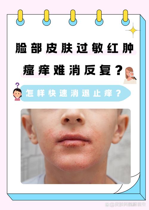 脸过敏了用擦护肤品吗