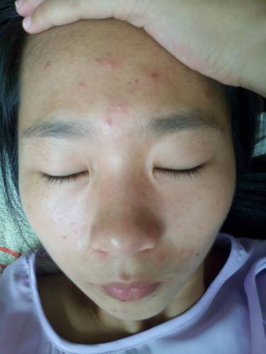 女生豆豆是什么