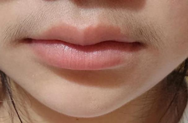 女生为什么长胡子