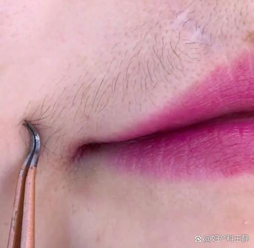 女生为什么长胡子