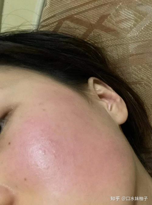 温碧泉护肤品会过敏吗