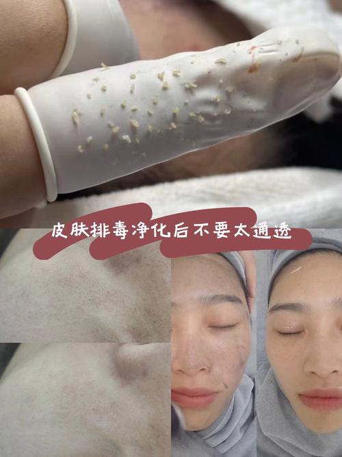 用护肤品排毒是怎样的