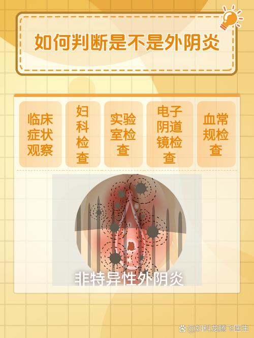 妇科病是什么症状