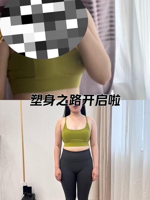 局部减肥什么效果最好