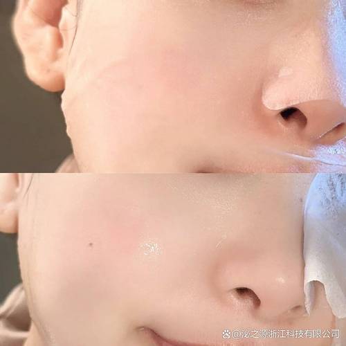 刚敷完面膜用护肤品吗