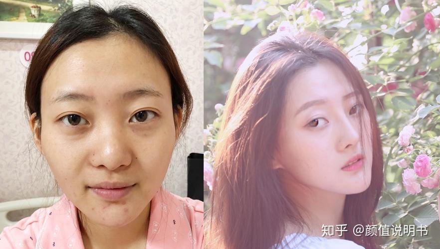 南京华美减肥什么价格