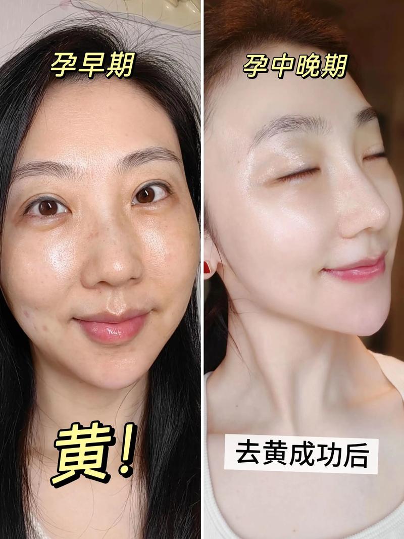 孕妇能不能涂护肤品吗