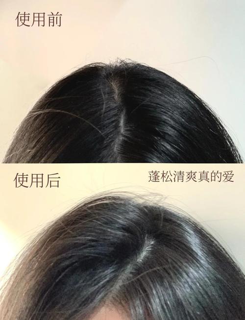 沙发用什么洗发水