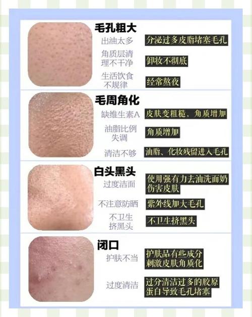 去黑头的护肤品排行榜