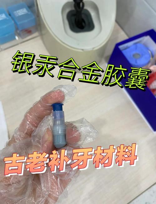 补牙齿用什么材料
