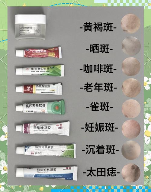 有黄褐斑用什么护肤品