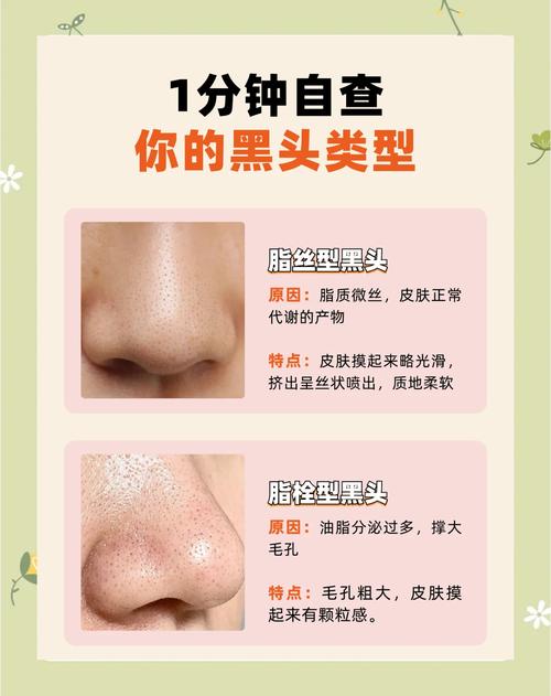 有黑头可以用护肤品吗