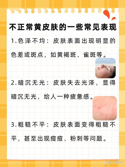 身上发黄是什么病