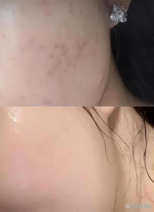 洗面奶洗了脸有点干疼