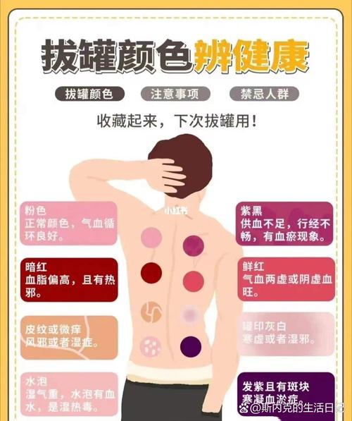 拔罐减肥的原理是什么意思