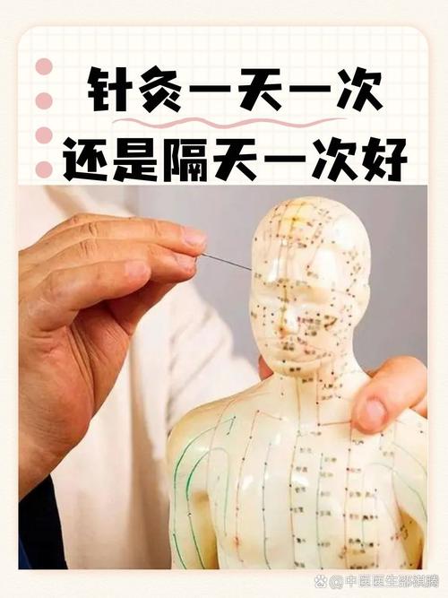 针灸减肥什么原理